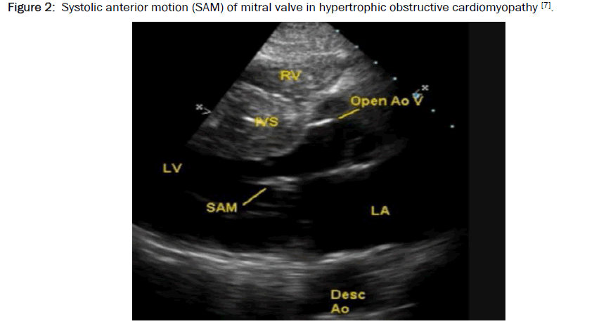 Systolic