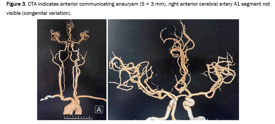 biology-demonstrated-aneurysm