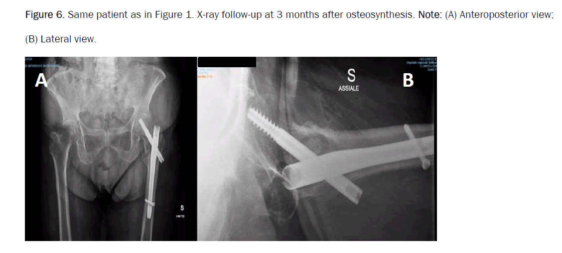 orthopedics-anteroposterior