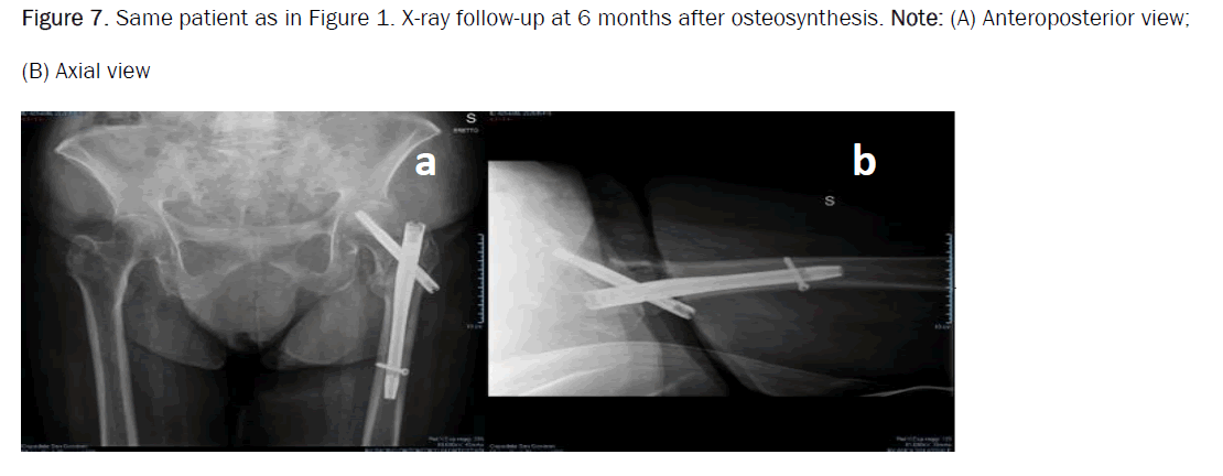 orthopedics-axial