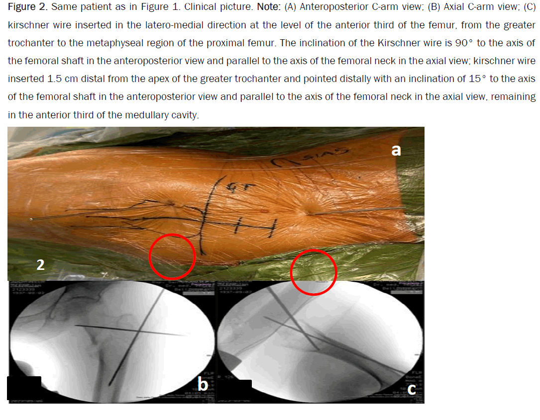 orthopedics-kirschner