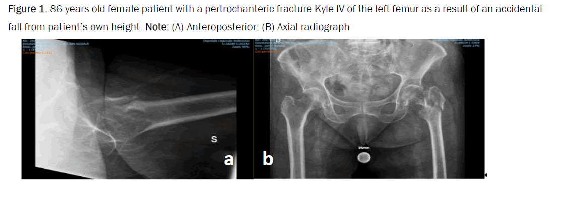 orthopedics-pertrochanteric